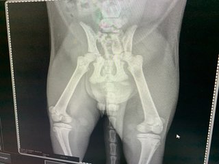 My x-ray that showed fractures 