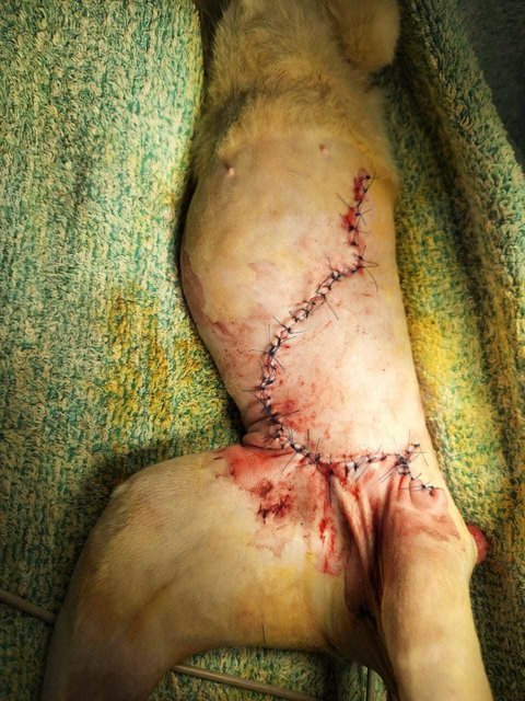 Hara's belly wound post-surgery