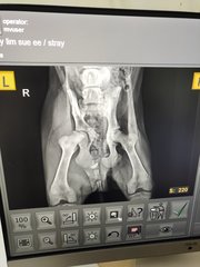 Xray taken reveal pelvic and femoral head fracture